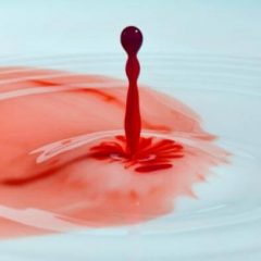 Waspada, 5 Kondisi Menstruasi Tidak Normal Ini Perlu Kamu Tahu Girls!